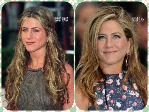 Jennifer Aniston 2000 2014 Forehead