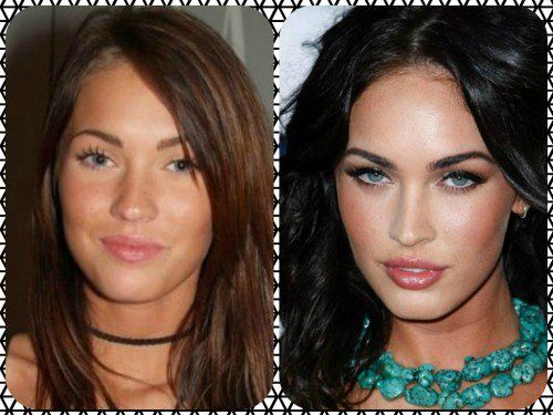 Megan Fox Plastic Surgery