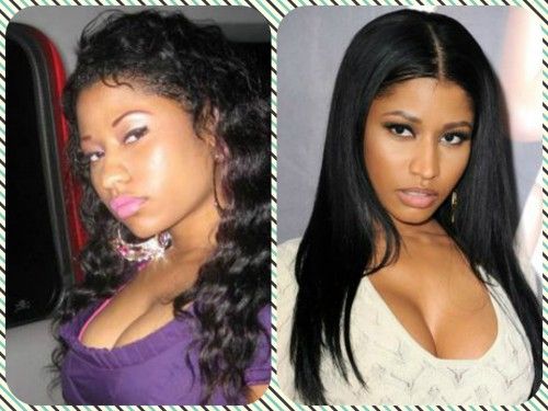 Nicki Minaj Plastic Surgery