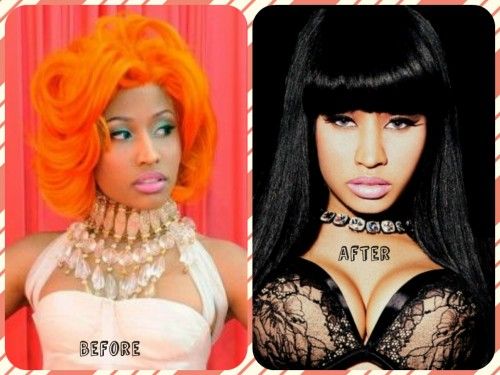 Nicki Minaj Plastic Surgery 